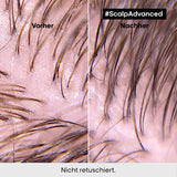 L'Oréal Professionnel čisticí šampon na mastnou pokožku hlavy, 300 ml Naty Shop sprcha a koupel
