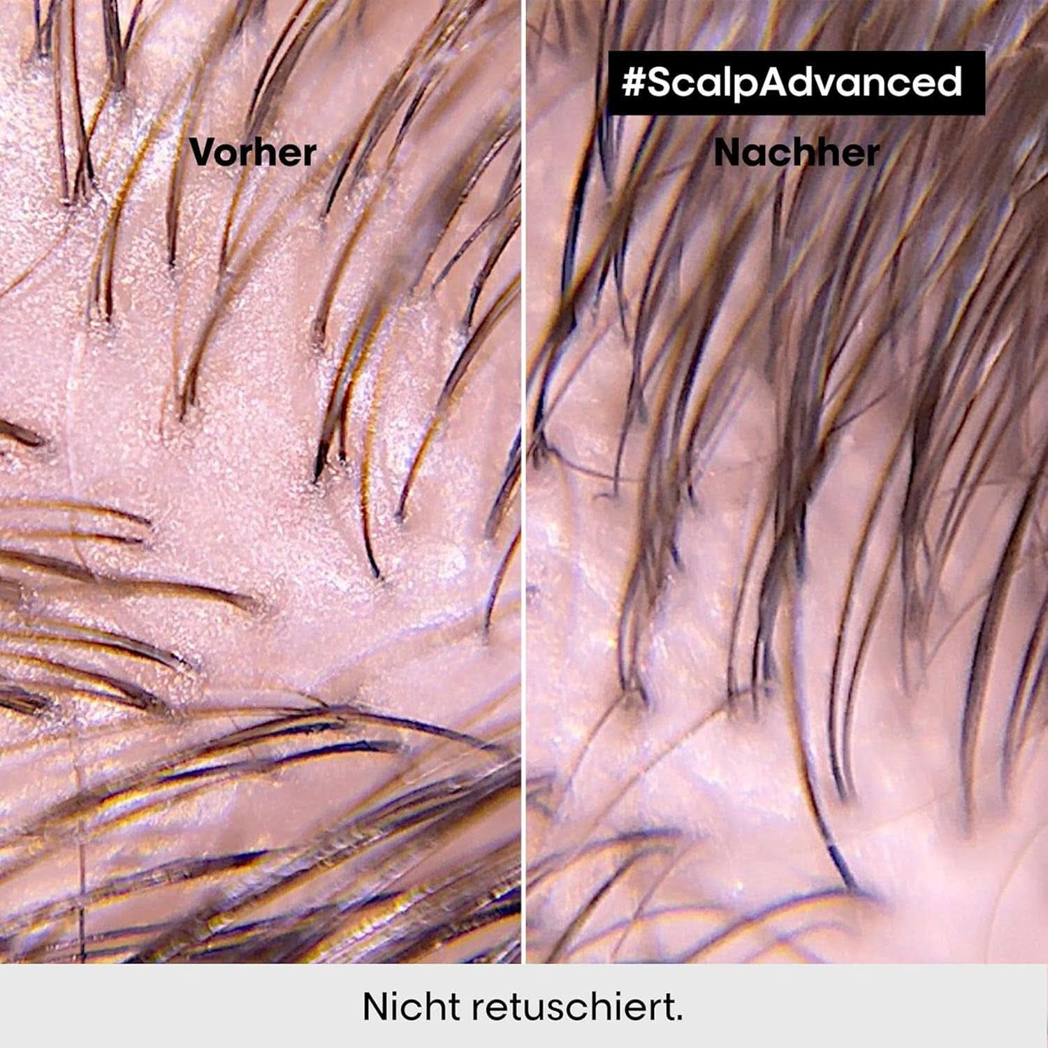 L'Oréal Professionnel čisticí šampon na mastnou pokožku hlavy, 300 ml Naty Shop sprcha a koupel