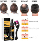 Sada Advanced Hair Growth Treatment Kit 30 ml 2ks Sprej pro růst vlasů Váleček a esence sada pro růst vlasů Sérum na růst vlasů proti vypadávání vlasů Sérum pro pokročilý růst vlasů Péče o vlasy Naty Shop