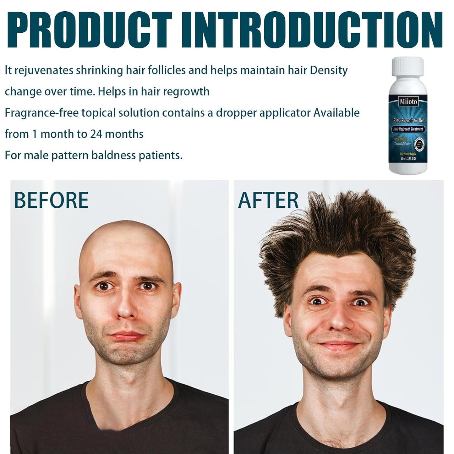 Miioto Sérum pro růst vlasů Muži Produkt pro růst vlasů Produkt Sérum pro růst vlasů Péče o vlasovou pokožku Podporujte hustší vlasy Vyživujte vlasovou pokožku Zabraňte vypadávání vlasů 3*60ML Péče o vlasy Naty Shop