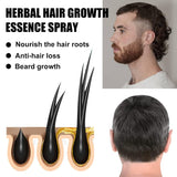 Sada Advanced Hair Growth Treatment Kit 30 ml 2ks Sprej pro růst vlasů Váleček a esence sada pro růst vlasů Sérum na růst vlasů proti vypadávání vlasů Sérum pro pokročilý růst vlasů Péče o vlasy Naty Shop