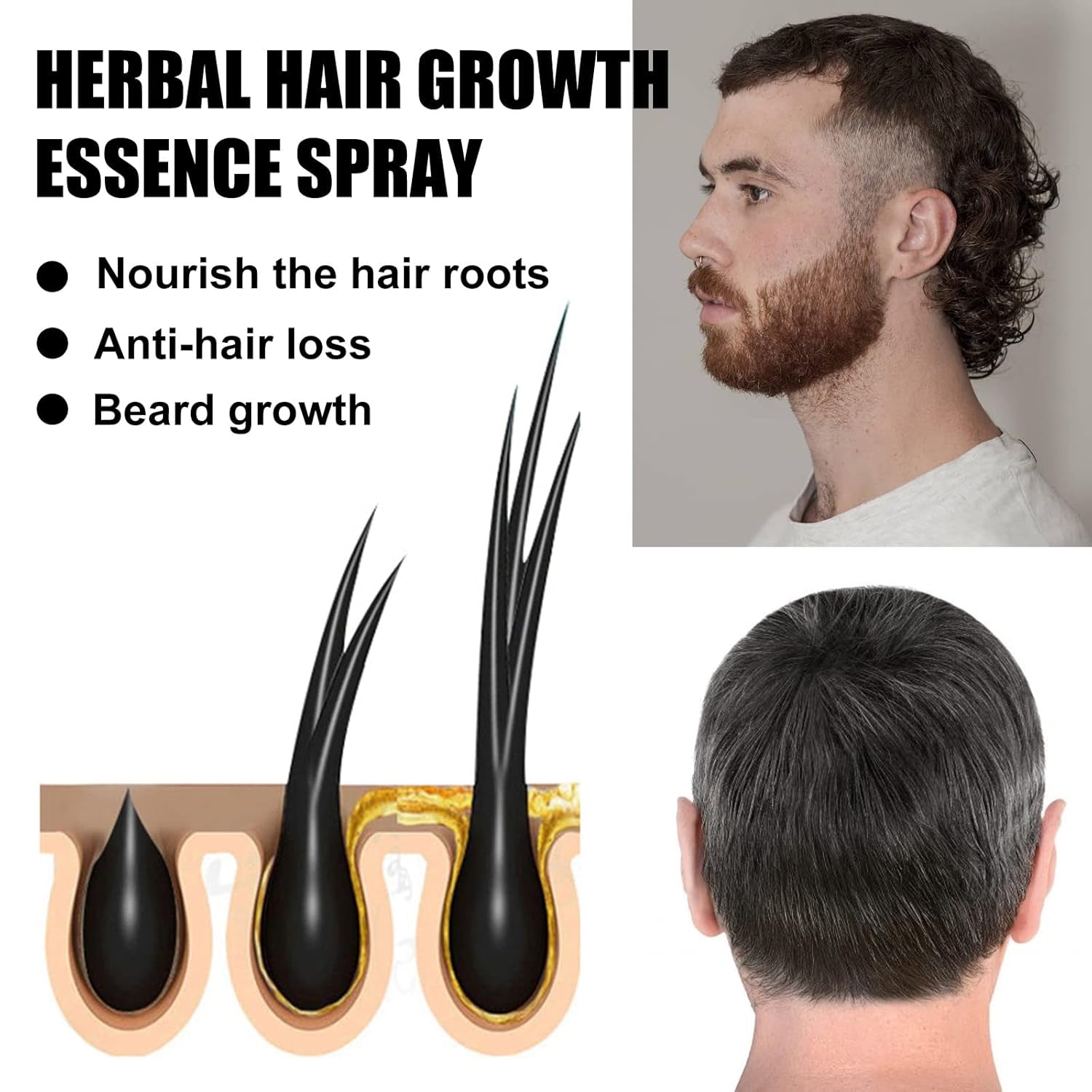 Sada Advanced Hair Growth Treatment Kit 30 ml 2ks Sprej pro růst vlasů Váleček a esence sada pro růst vlasů Sérum na růst vlasů proti vypadávání vlasů Sérum pro pokročilý růst vlasů Péče o vlasy Naty Shop