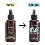 MOÉRIE Ultimate Mineral Hair Growth Spray pro delší, hustší a plnější vlasy - s biotinem a kofeinem - Veganské vlasové produkty, Bez parabenů, Všechny typy vlasů, zamezuje vypadávání vlasů - 2měsíční nabídka Péče o vlasy Naty Shop